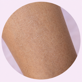 Dry skin