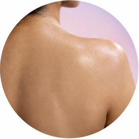 Oily back and shoulders